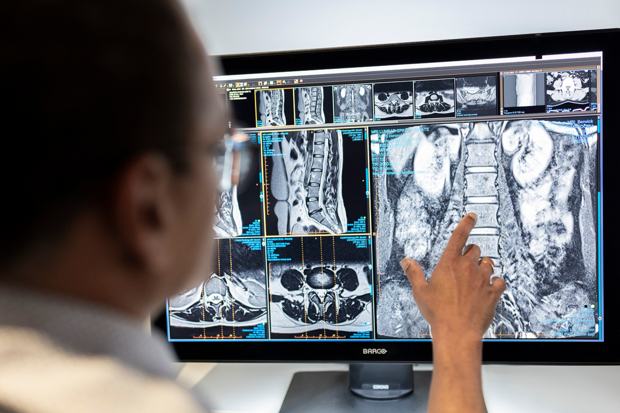 Doctor Analysing Medical Xray Results of Patient | Ultrasound Services | Fowler Simmons Radiology